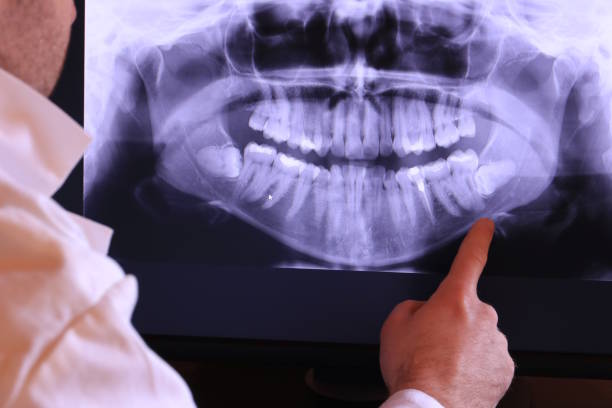 Best Broken or Chipped Tooth Repair in Boiling Springs, SC
